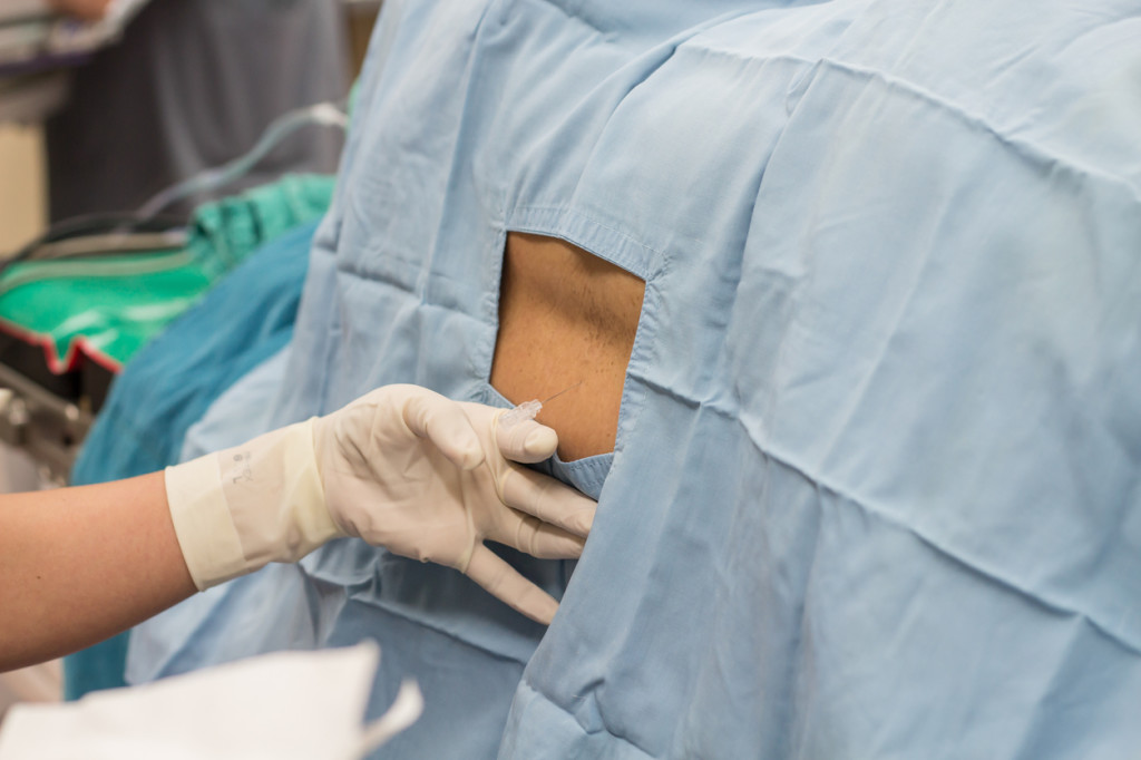 Facet Joint Block Injections | Comprehensive Pain Management Center