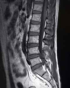 Spinal Column Problems | ComprehensivePainManagementCenter.com